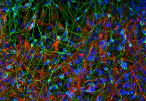 Cellules souches neurales (en rouge, avec les noyaux en bleu) et neurones (en vert), © Karmacharya R et coll.*
