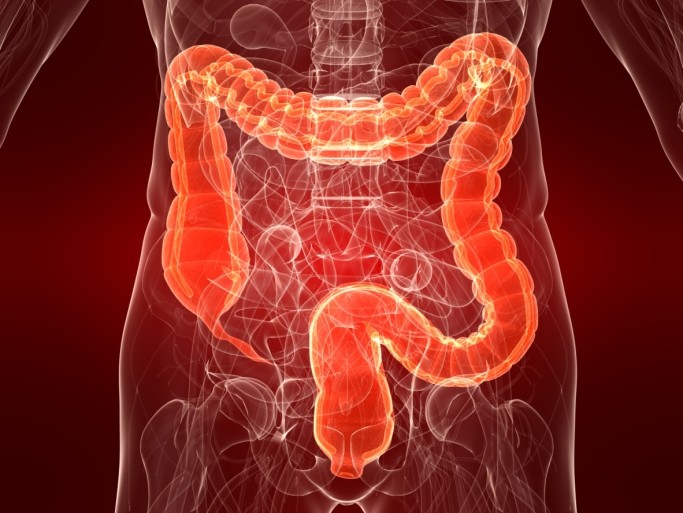 La maladie de Crohn est une maladie inflammatoire intestinale chronique évoluant par poussées