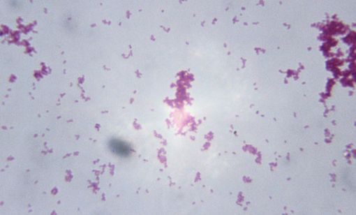 Gonocoques (Neisseria Gonorrhoeae) vus au microscope