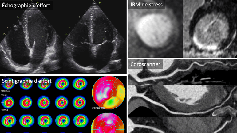 Éviter de demander les examens en parallèle, mais suivre une démarche pas à pas.