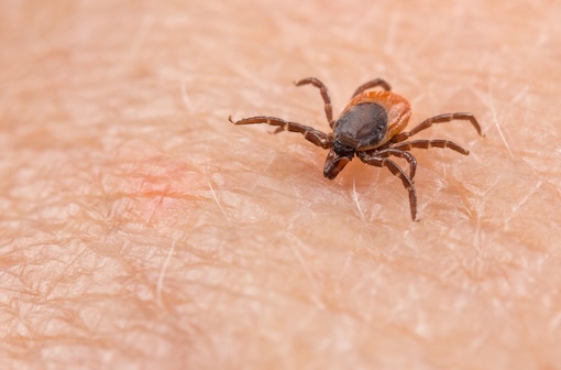 En France, <em>Ixodes ricinus</em>, la tique la plus courante, est à l'origine du syndrome de l'alpha-gal.