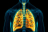 L’hypertension artérielle pulmonaire est une maladie vasculaire pulmonaire rare et grave définie par l’augmentation des résistances artérielles pulmonaires, évoluant vers l’insuffisance cardiaque droite (illustration).
