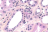 Tubules distaux rénaux (Coloration Hémalun Phloxine Safran - Grossissement x 400 ) [photo @ BioImageFree.fr]