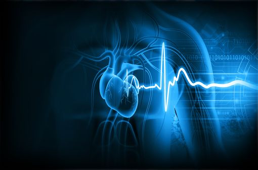 Les patients à risque traités par ARICEPT ou génériques doivent faire l'objet d'une surveillance par électrocardiogramme (illustration).