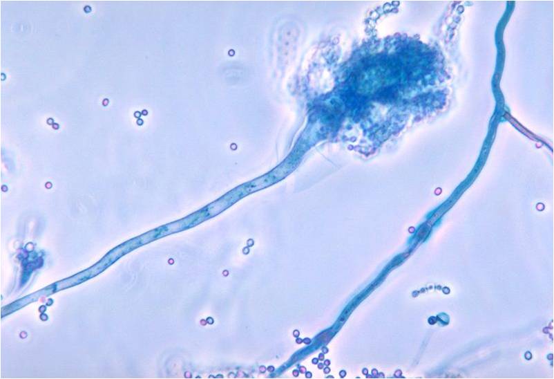 Les Microsporidies sont une division de champignons parasites intracellulaires obligatoires, appartenant au règne des Fungi (illustration @ Dr Libero Ajello, CDC - Wikimedia).