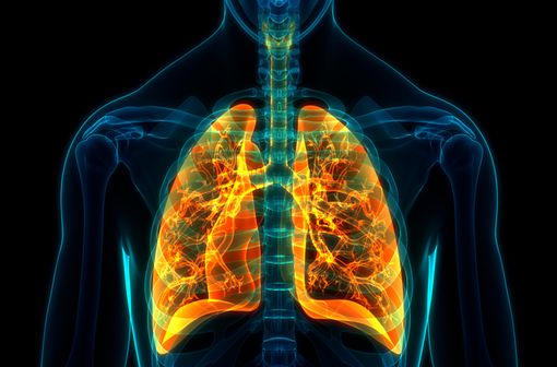 La BPCO est une maladie respiratoire chronique due à une inflammation et une obstruction permanente et progressive des bronches (illustration).