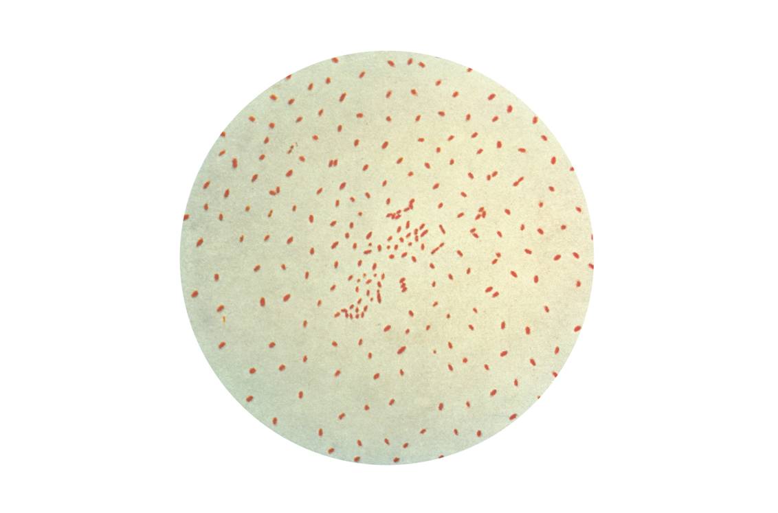 Bacteries Bordetella pertussis - coloration de Gram (illustration @ CDC Public Health Image Library, Wikimedia)