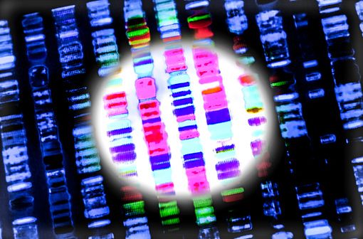L’angiÅ“dème héréditaire est une maladie génétique qui induit un déficit en inhibiteur de la C1 estérase dont le gène est situé sur le 11e chromosome (illustration).