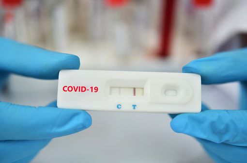 Pour faciliter et accélérer le dépistage de l'infection COVID-19, l'État a autorisé le recours à des tests antigéniques dont les résultats sont obtenus en moins de 30 minutes (illustration).