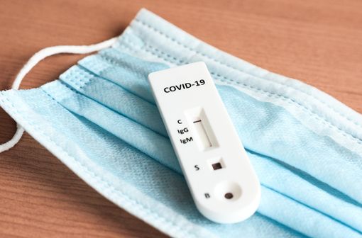 Les indications des tests sérologiques COVID-19, automatisables ou rapides, en diagnostic et en dépistage pré-vaccinal ont évolué (illustration).