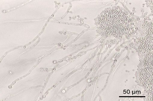 Candida albicans vus au microscope (illustration @Y Tambe sur Wikimedia)
