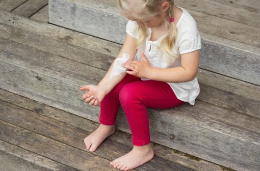 L'eczéma est relativement fréquent chez les enfants, en particulier au niveau des plis (illustration).