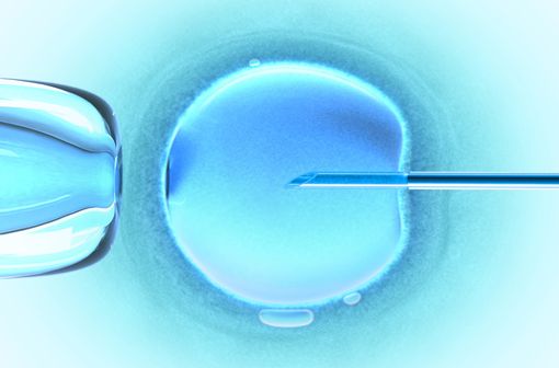 Injection intracytoplasmique de spermatozoïdes dans un ovule (illustration).