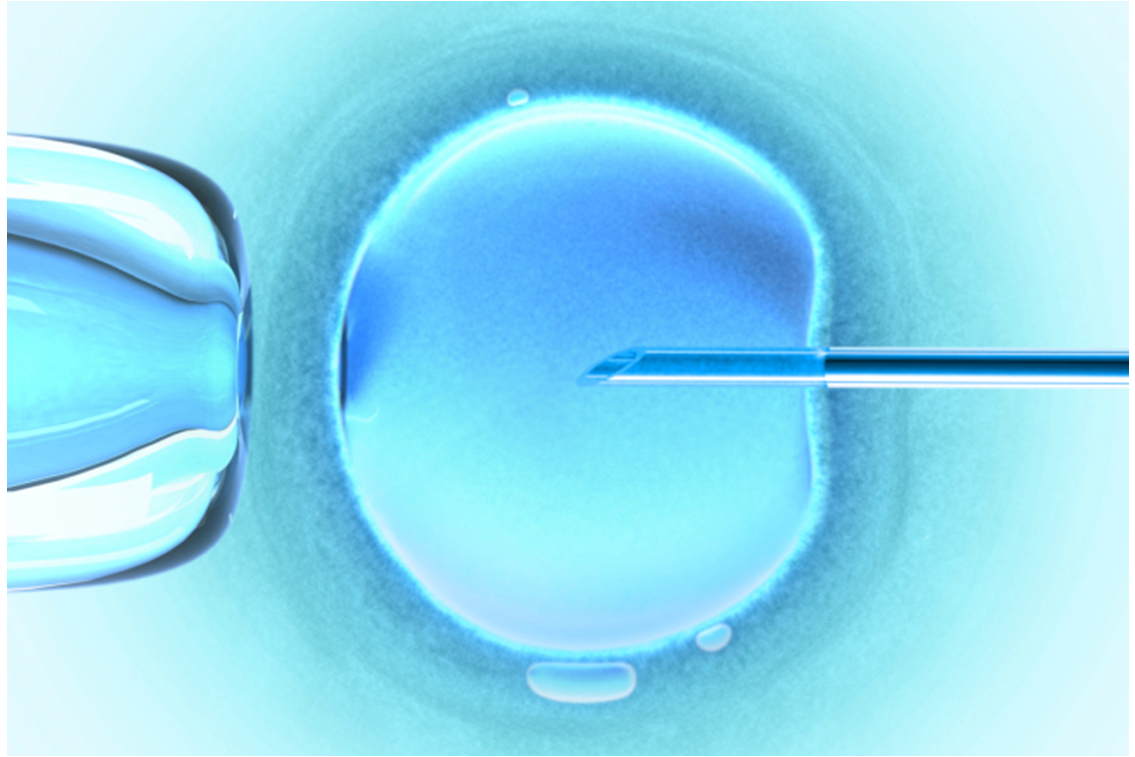 Fécondation in vitro.
