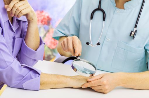 Les patients traités par hydrochlorothiazide doivent vérifier régulièrement l'état de leur peau et faire examiner toute lésion cutanée suspecte par leur médecin (illustration).