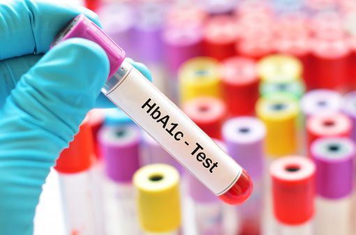 Le dosage de l'HbA1c permet d'évaluer la glycémie moyenne sur plusieurs mois, du moins en l'absence d'anomalie des globules rouges (illustration).