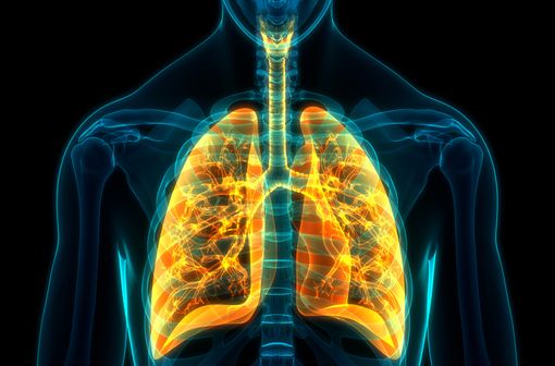 Environ deux tiers des cas de cancer bronchique non à petites cellules (CBNPC) localement avancés sont diagnostiqués à un stade déjà non opérable (illustration).