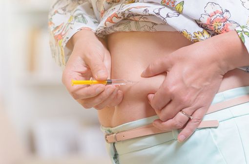 L'injection sous-cutanée de l'énoxaparine doit être réalisée dans le tissu cellulaire sous-cutané de la ceinture abdominale alternativement du côté droit et du côté gauche (illustration).