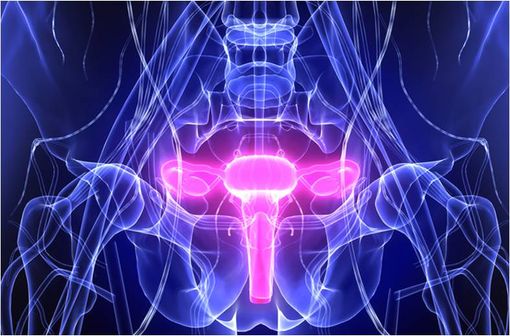 LYNPARZA est notamment indiqué dans le traitement d'entretien de certains cancers épithéliaux avancés de haut grade de l'ovaire, des trompes de Fallope ou péritonéal primitif avec mutation des gènes BRCA1/2 (illustration).