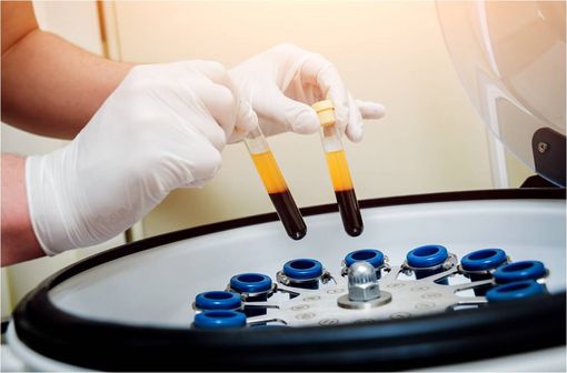 Les médicaments dérivés du plasma sanguin sont des produits issus du fractionnement du plasma sanguin, tels l'albumine, les immunoglobulines, certains facteurs de coagulation, les antiprotéases ou les colles biologiques (illustration).