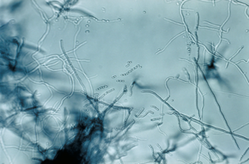 La mitomycine C est issue de Streptomyces caespitosus ; elle a été découverte en 1955 par des chercheurs japonais (illustration @Wikimedia).