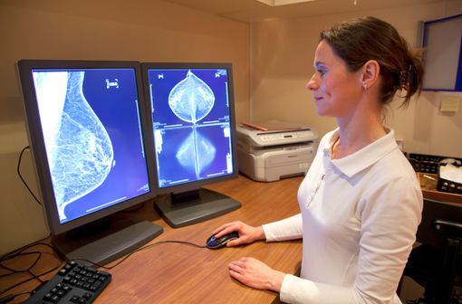 Le dépistage organisé du cancer du sein s'effectue par mammographie (illustration).