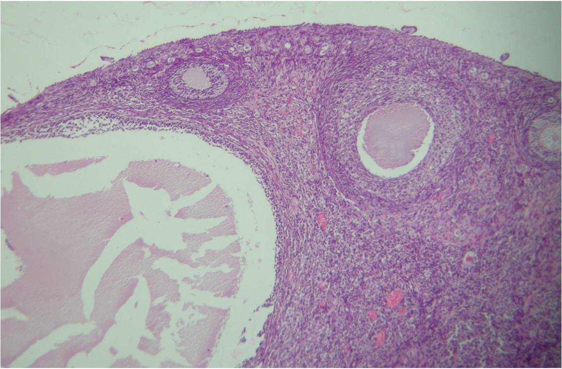 Coupe d'un ovaire en vue au microscopique (cliché @ Thomas Bresson, Wikimedia).