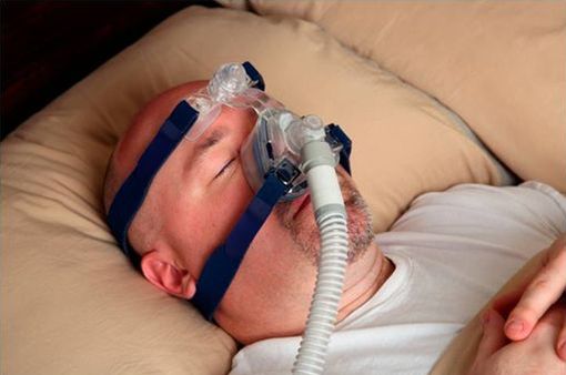 Patient souffrant d'apnées du sommeil et dormant avec un dispositif à PPC (illustration).