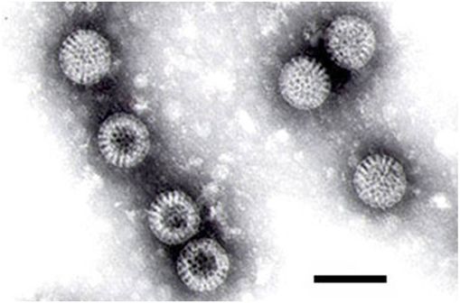 Rotavirus en microscopie électronique (photo @ FP Williams, U.S. EPA, sur Wikimedia).