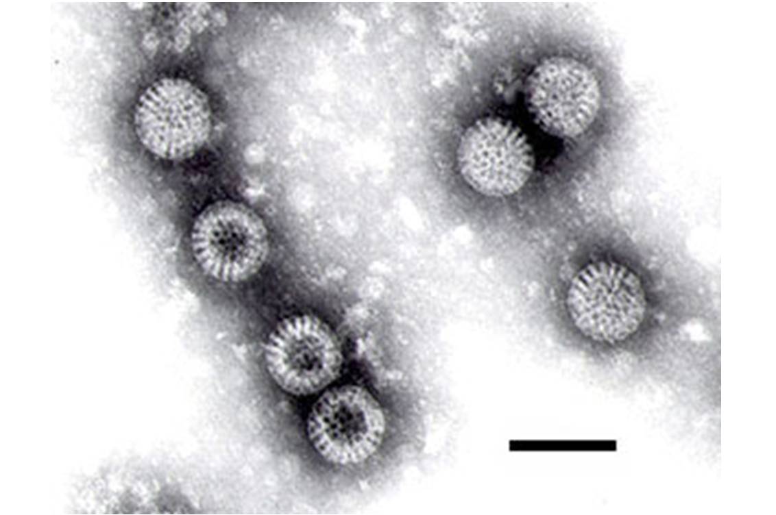 Les rotavirus sont la 1re cause de diarrhée aiguë sévère du jeune enfant dans le monde (image : @ F.P. Williams, U.S. EPA, Wikimedia).