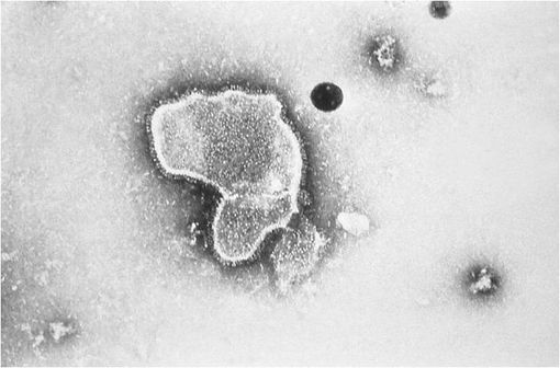 Virus respiratoire syncytial au microscope électronique (illustration @CDCP sur Wikimedia).