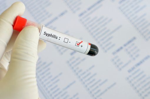 L'association benzathine benzylpénicilline est notamment indiquée dans le le traitement de la syphilis et de maladies apparentées.