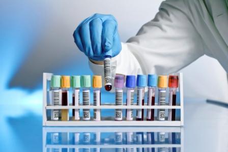 En cas de confirmation de la prolongation isolée du TCA, avec ou sans saignement, l’hémophilie acquise doit être envisagée.