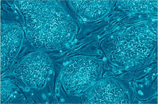 Cellules souches embryonnaires humaines encore indifférenciées (illustration @Nissim Benvenisty - Russo E. PLoS Biol 2005 ; 3(7): e234).