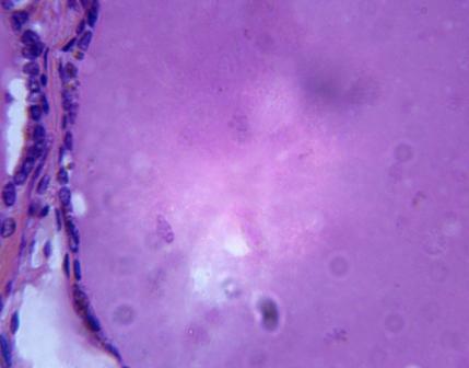 Glande thyroïde (image microscopique)