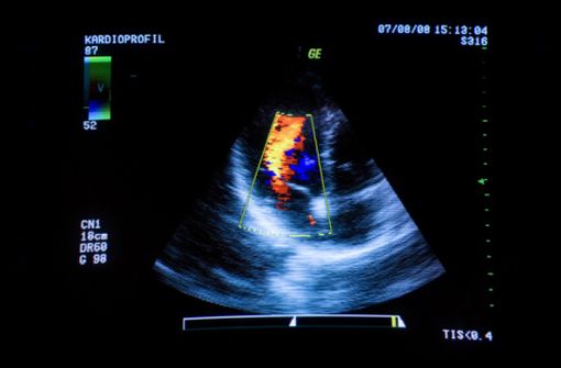 Echographie cardiaque (illustration).